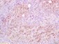 CD5L Polyclonal Antibody